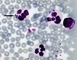 Anaplasma P. Parasite infects white blood cells. (CC BY-SA 3.0)
