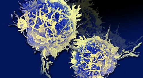 Producenty jednoho z protizánětlivých interleukinů jsou pomocné T lymfocyty (Th17 buňky). Kredit: The New York Academy of Sciences.
