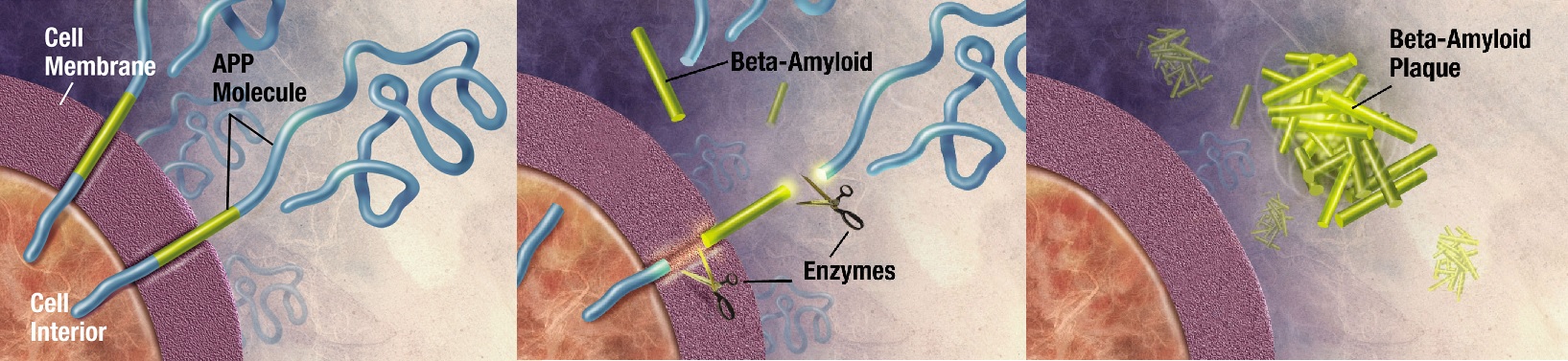 Enzymy stříhají prekurzor proteinu amyloidu beta (APP) na fragmenty. Úlomky beta-amyloidu se v mozku slepují do amyloidních plaků - jeden z nejvýraznějších projevů Alzheimerovy choroby. Kredit: National Institute on Aging, Wikipedia, volné dílo.