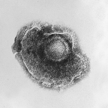 Snímek viru varicely, tedy viru planých neštovic z elektronového mikroskopu. Nemoc způsobená varicella zoster virem se projevuje vyrážkou připomínající puchýře, svěděním, únavou a horečkou. Překonáním člověk získává celoživotní ochranu vůči viru, kte
