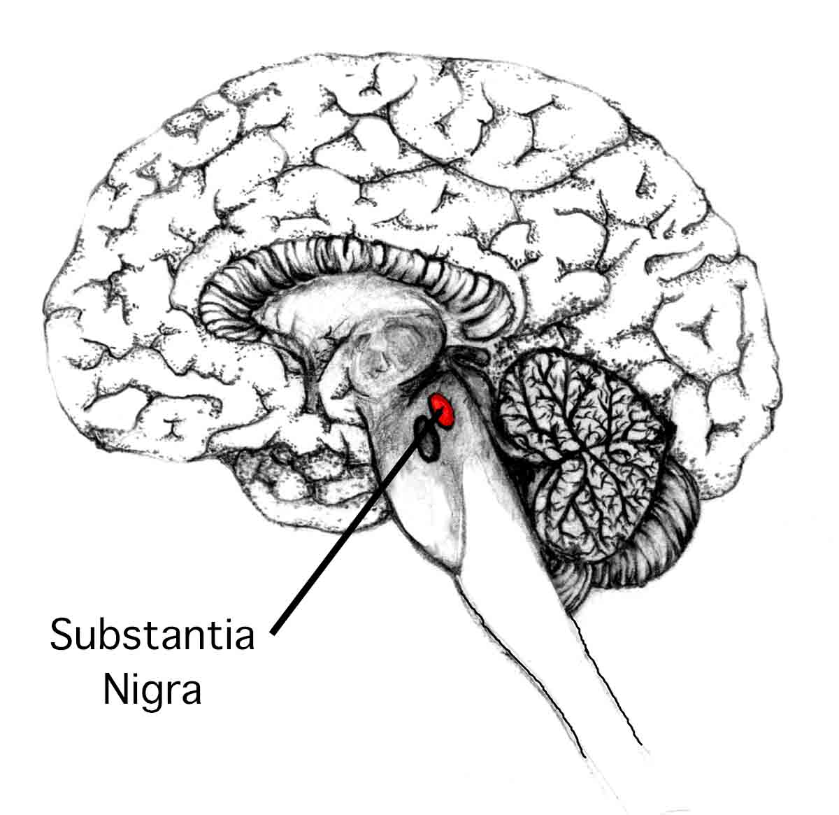 Nejen astronomové, i patologové mají svou „temnou hmotu“ - substantia nigra.  Právě tam se nemocným Parkinsonovou nemocí v neuronech začnou objevovat hnědě zbarvená Lewyho tělíska.