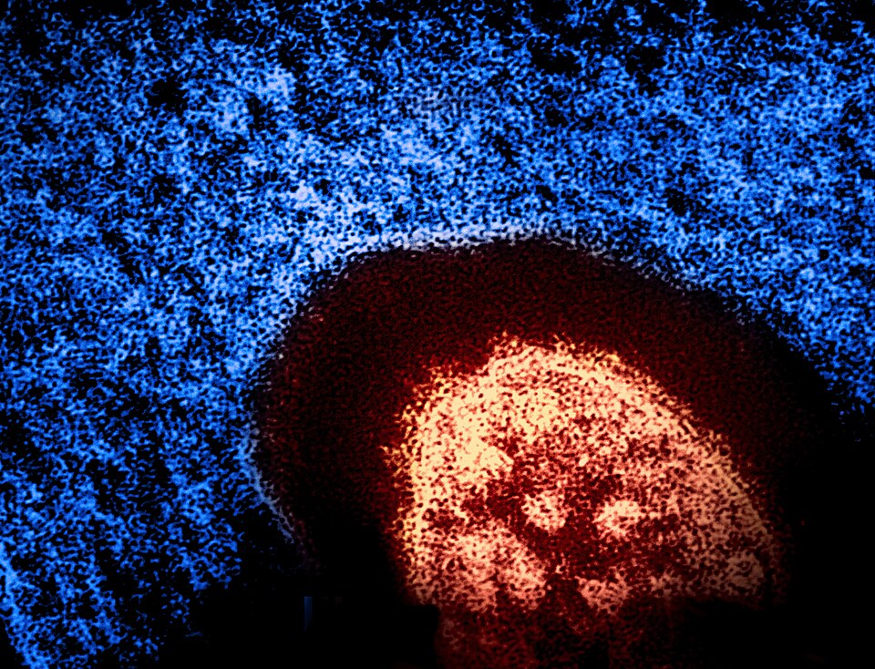 Populární virus neštovic. Kredit: NIAID, Wikimedia Commons.