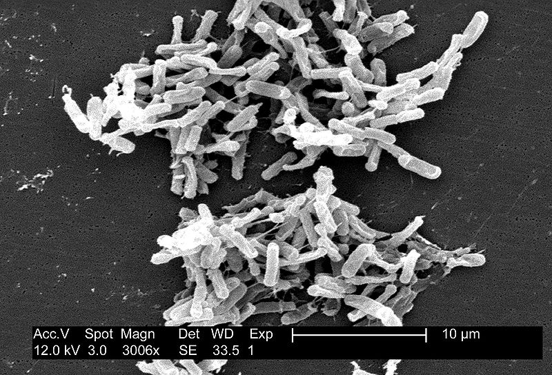 PĹŻvodce nezvlĂˇdnutelnĂ˝ch stĹ™evnĂ­ch infekcĂ­, na nÄ›Ĺľ jsou i antibiotika krĂˇtkĂˇ v elektronovĂ©m mikroskopu. (Kredit: CDC, Wikimedia Commons)