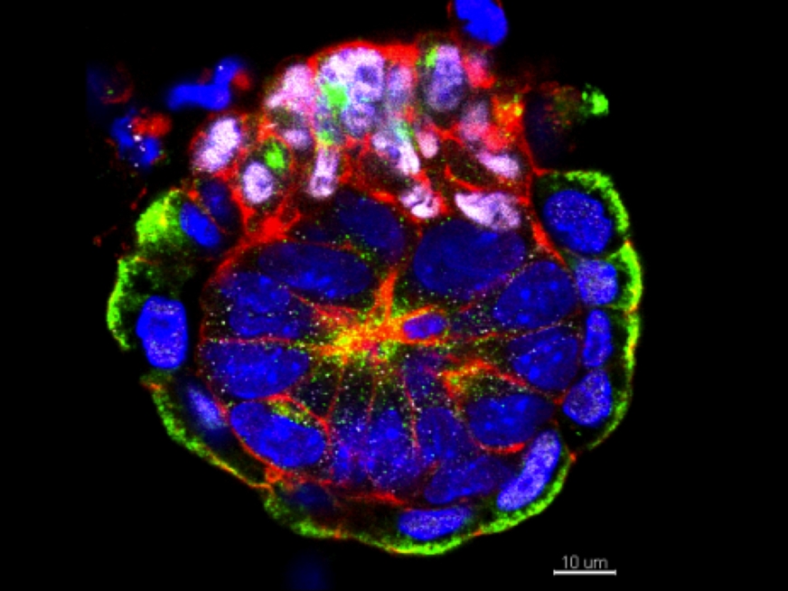Takto vypadá embryo (půvpdně blastocysta tvořená několika blastomerami) na němž si výzkumníci jednotlivé buňky označili různými barvičkami (červenou, modrou a zelenou). Barvička dovoluje sledovat, jaké části zárodku ta která buňka dává vznik. Kredit: