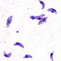 AktivnĂ­m stĂˇdiĂ­m prvoka Toxoplasma se Ĺ™Ă­kĂˇ tachyzoiti. SvĂ˝mi dlouhĂ˝mi prsty sahajĂ­ aĹľ do naĹˇich mozkĹŻ a nĂˇlad. Jistou formu hloupnutĂ­ nĂˇm nejspĂ­Ĺˇ kompenzujĂ­ vÄ›tĹˇĂ­ odolnostĂ­ pĹ™ed rakovinou. (Kredit: DPDx Parasite Image Library)