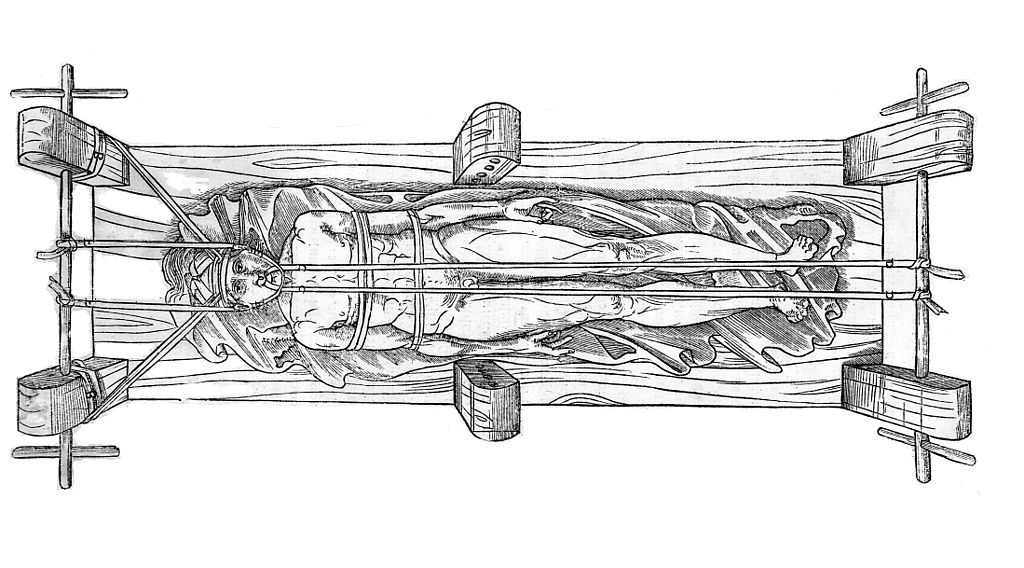 Napravování zlomenin nebo spíš vykloubenin, z téže publikace. Kredit: Wikimedia Commons.