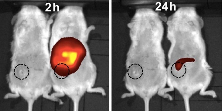 ĂšspÄ›ĹˇnĂ˝ zĂˇsah nanoÄŤĂˇstic proti lidskĂ©mu nĂˇdoru prsu vÂ myĹˇi. Kredit: American Chemical Society.