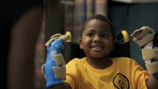 Zion Harvey se ve svĂ˝ch osmi letech stal prvnĂ­m dÄ›tskĂ˝m pacientem s transplantovanĂ˝ma rukama.  Kredit: The Childrens Hospital of Philadelphia