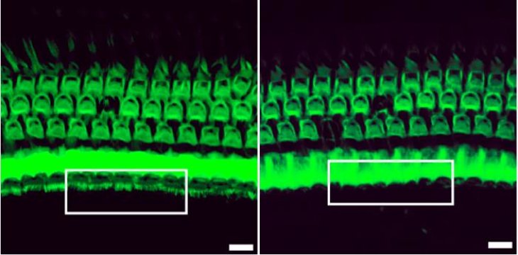 Výsledek práce editoru. Vlevo vláskové buňky myši po zásahu, vpravo tkáň neošetřené myši. Kredit: Gao et al. /Nature 2017.