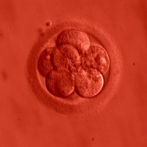 LidskĂ© embryo. 3 dny, 8 bunÄ›k. Kredit: ekem / Wikimedia Commons.