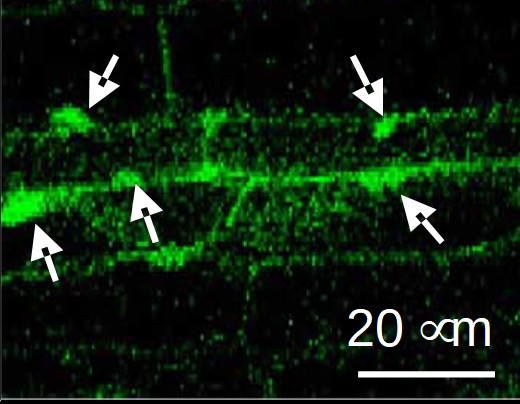 Zobrazení fotoreceptoru phy B, který je po ozáření přesunován do jádra. Zobrazení bylo provedeno pomocí fluorescenčního proteinu navázaného na fotoreceptor. Kredit: Hyo-Jun Lee, SNU.