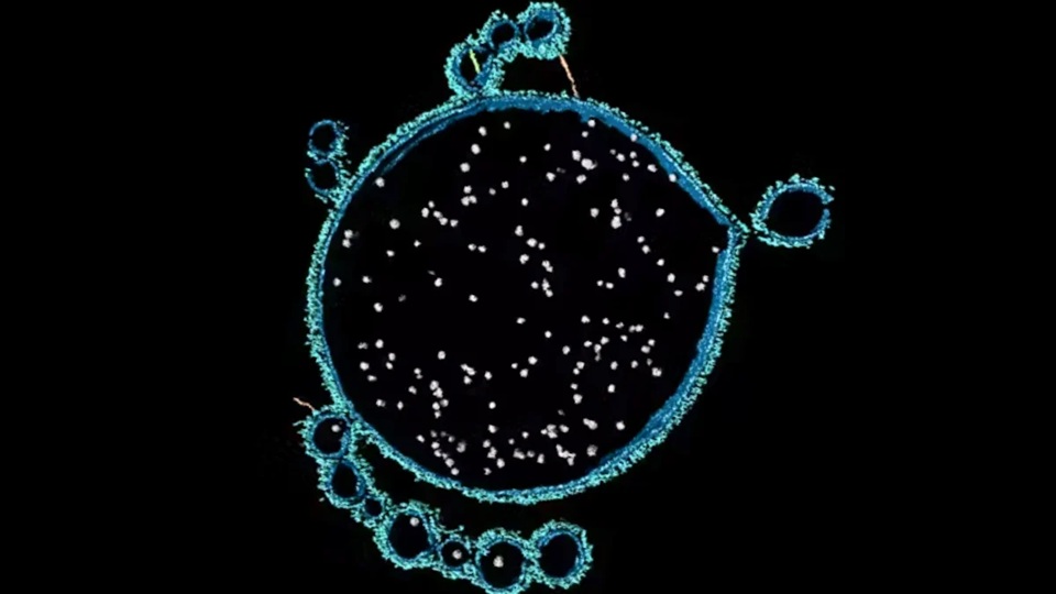 Nově objevené nerearchaeum. Kredit: Debnath Ghosal.