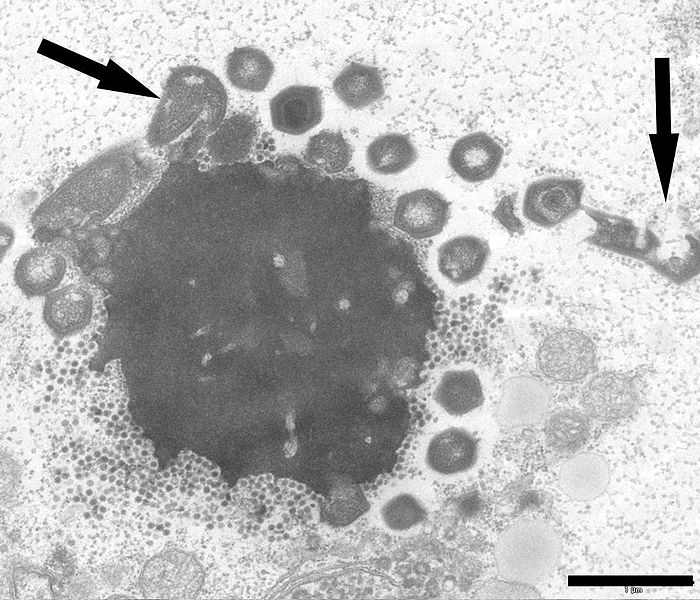 VirovĂˇ tovĂˇrna mimiviru Mont1 uvnitĹ™ amĂ©by, infikovanĂˇ virofĂˇgem Zamilon (teÄŤky velikosti mĂˇku). Kredit: Gaia et al. (2014), PLoS One.