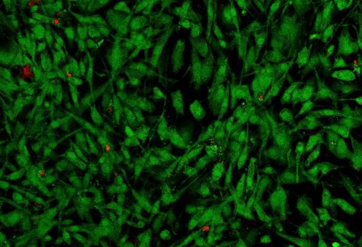 Buňkám v syntetické matrici chrupavky se daří skvěle. Zelené jsou naživu, do mrtvých prostoupilo červené barvivo. To, že červených je více než poskrovnu, je velkým příslibem klinické aplikovatelnosti.  Kredit: Lizhi Xu.  (Kotov lab. University of Mic