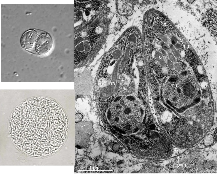 VLEVO NAHOŘE: Sporulovaná oocysta Toxoplasma gondii, zvětšeno 100x. (Kredit: Wikimedia Commons, volné dílo).  
VPRAVO: Dva tachyzoity toxoplasmy uzavrené v parazitoforní vakuolární membráně v buňce v plících holuba. (Kredit: Jacques Rigoulet et al.,