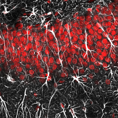 Toto barvenĂ­ neumoĹľĹ?uje rozliĹˇit jednotlivĂ© typy neuronĹŻ, zato je na nÄ›m vidÄ›t, jak to v mozku vypadĂˇ. Neurony jsou doslova â€žzasĂ­ĹĄovĂˇnyâ€ś bĂ­lĂ˝mi astrocyty. (Kredit: Jason Snyder. Licence: CC BY 2.0. Source: https://flic.kr/p/aDcSZ5)