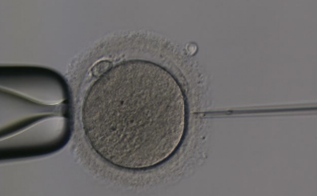 Intracytoplazmatická injekce spermie do vajíčka (ICSI: intracytoplasmic sperm injection). Dnes již ikonický obrázek a synonymum pro IVF (in vitro fertilizace). Skutečnost je poněkud složitější: ICSI je jednou z metod IVF, byť v dnešní době a v někter