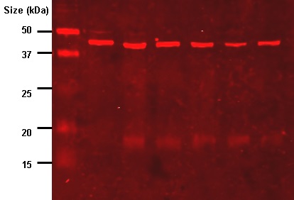 Výsledek imunoblotu (western blotu) z extraktu prvoka rodu Leishmania, zvýrazněno barvivem citlivým na infračervené světlo. Vpravo je označení molekulové hmotnosti hledaných proteinů v kilodaltonech. Kredit: Tim Vickers, Wikipedia CC 3.0