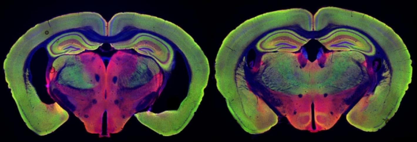 Senzorická stimulace pulzy bílého světla s frekvencí 40Hz světlu zabrzdila neurodegenerativní změny v mozku myši s Alzheimerovou nemocí (vpravo). Pro porovnání vlevo je mozek stejně staré, ale neléčené myši se stejnou genetickou predispozicí. Její mo