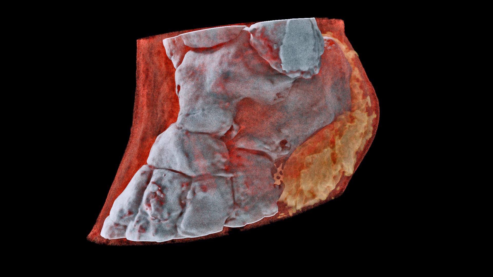 Barevný 3D rentgenový snímek kotníku. Zobrazuje kosti, měkké tkáně i tuky. Kredit: Mars Bioimaging.