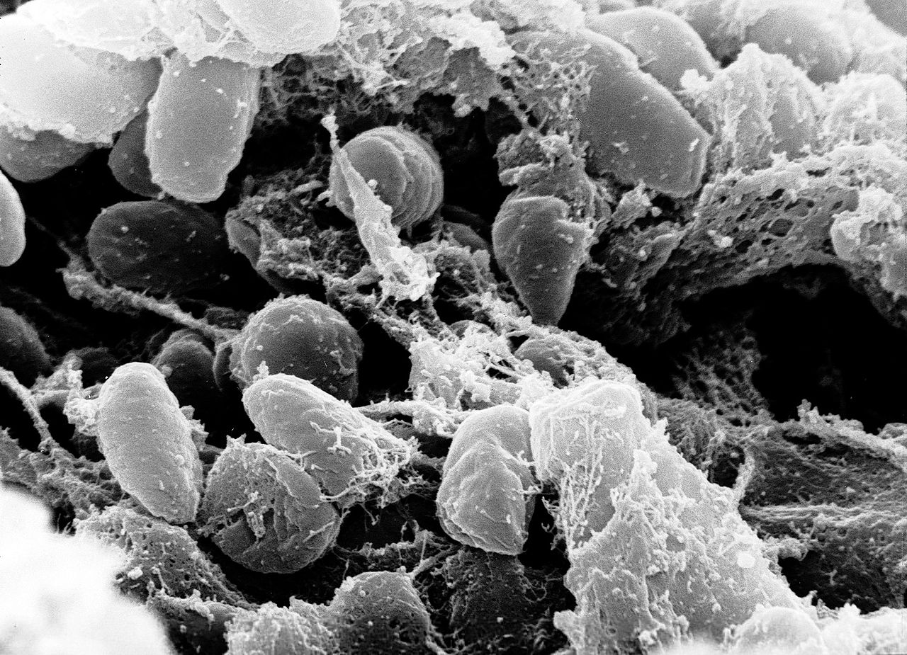 Yersinia pestis (původně Pasteurella pestis) je patogenní bakterie přenositelná ze zvířete i na člověka. Infekce se může projevit třemi formami - dýmějovou, septickou (otrava krve) a plicní. Inkubační doba 2–6 dnů. (Kredit: Volné dílo)