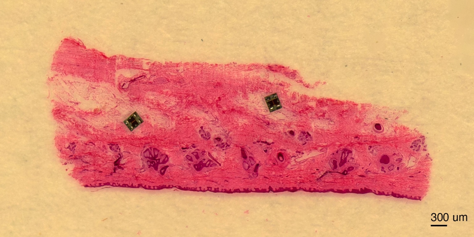 Mikroboti na tkáni. . Kredit: Maya Lassiter, University of Pennsylvania.