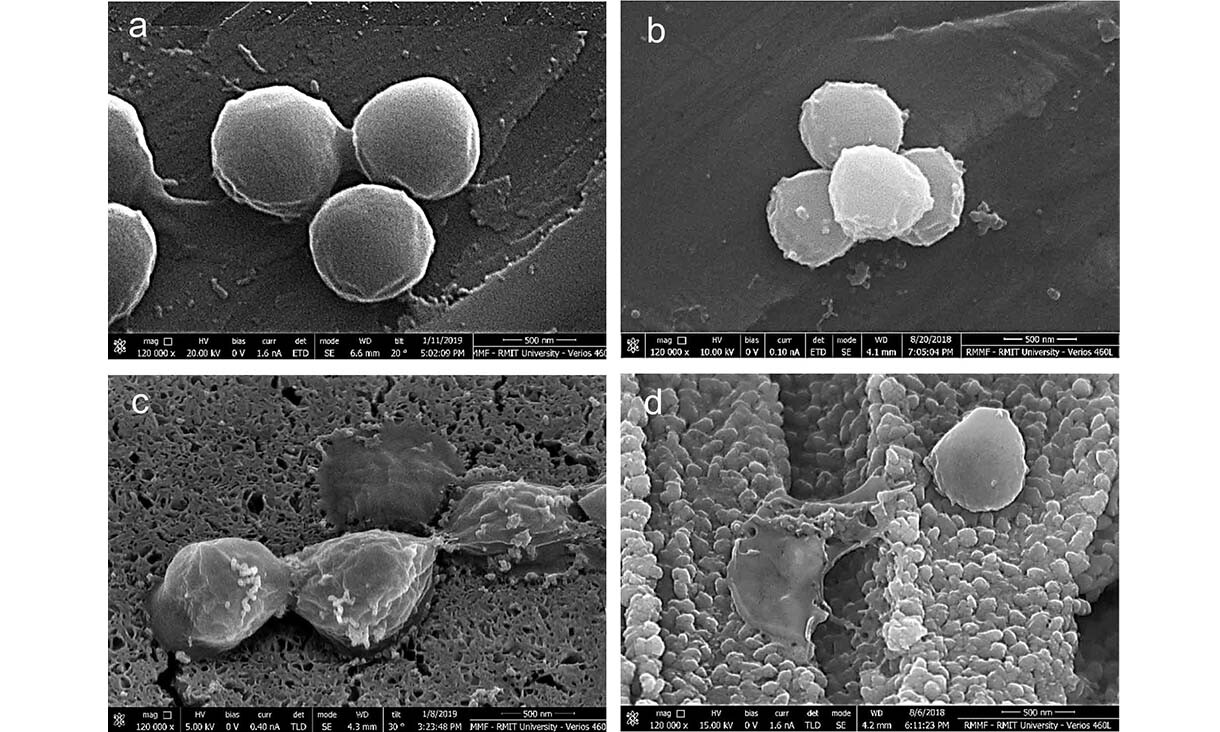 Zlaté stafylokoky po 2 minutách na a) nerezové oceli, b) standardní mědi, c) plus d) mikro-nanomědi. Kredit: RMIT.