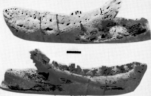 Fragment levé spodní čelisti tyranosaurida ze souvrství McRae s měřítkem o délce 10 cm. Dochovaná část je dlouhá 89,5 cm, její celková délka pak byla odhadnuta na 102,2 cm. Tím by tato kost přibližně o centimetr překonávala stejnou kost proslulého ob
