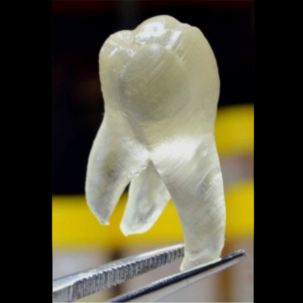3D tiĹˇtÄ›nĂ˝ antimikrobiĂˇlnĂ­ zub. Kredit: J. Yue et al. (2015).
