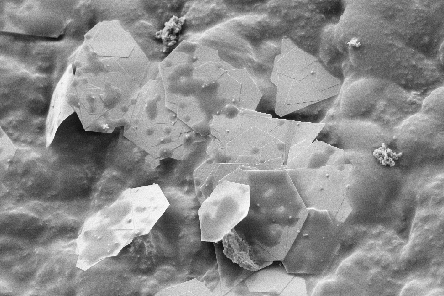 Nanodestičky zlata v latexové matrici. Kredit: Stephan Handschin/ScopeM/ETH Zurich.