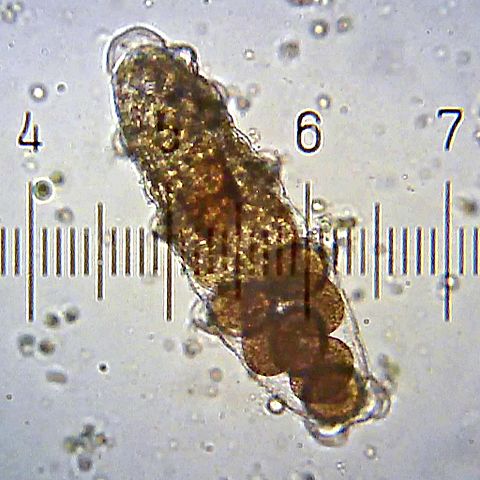 Ĺ˝elvuĹˇka v optickĂ©m mikroskopu. Kredit: Bob Blaylock / Wikimedia Commons.