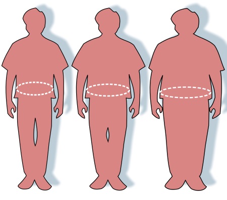 Pre belošskú európsku populáciu je podľa kritérií Svetovej zdravotníckej organizácie (WHO) definovaná indexom telesnej hmotnosti (body-mass index, BMI) vyšším ako 30. Pre ázijskú a pacifickú populáciu je obezita definovaná BMI vyšším ako 25, niekedy 