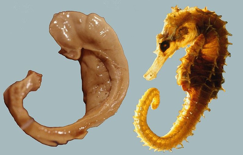 LidskĂ˝ hipokampus vs moĹ™skĂ˝ konĂ­k. Kredit: Laszlo Seress / Wikimedia Commons.