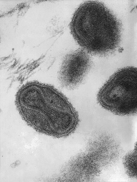 Velký a složitý virus neštovic. Kredit: CDC/ Fred Murphy; Sylvia Whitfield.