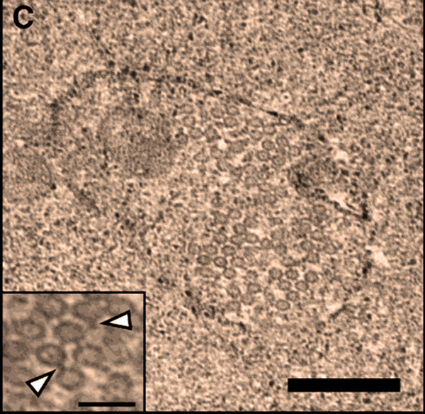 BuĹ?ka wolbachie naplnÄ›nĂˇ fĂˇgy. Na fĂˇgy vÂ detailu ukazujĂ­ i Ĺˇipky. Kredit: Bordenstein Lab / Vanderbilt University.