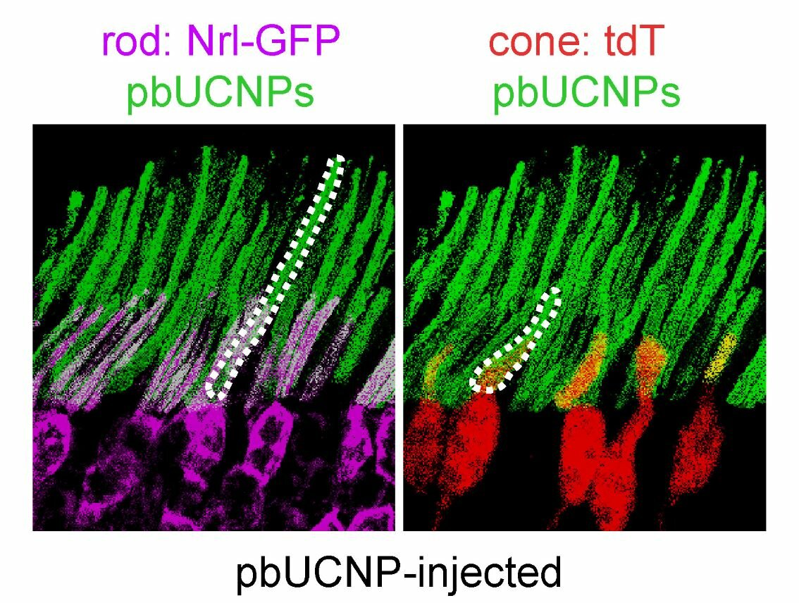 Na řezu sítnicí je vidět, že se nanočástice (zeleně) ochotně navázaly především na buňky zvané tyčinky (na obráku vlevo), do jisté míry i na kratší buňky zvané čípky (vpravo).  Kredit: Yuqian Ma, et al., 2019
