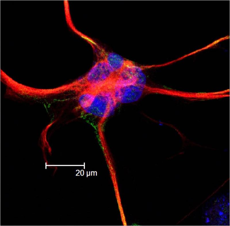 Atrocyt. MÄ›l to bĂ˝t jen pĹ™Ă­sluĹˇnĂ­k uklĂ­zecĂ­ ÄŤety. Je to ale uĹˇlechtilĂ˝ dĂˇrce mitochondriĂ­ a zachrĂˇnce neuronĹŻ v nesnĂˇzĂ­ch. (Kredit: Neurorocker, en-Wikipedia)