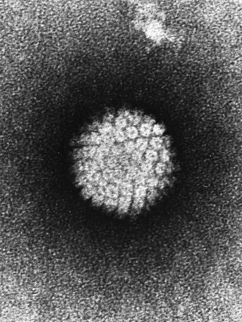 LidskĂ˝ papilomavirus (HPV),  jedna z nejÄŤastÄ›jĹˇĂ­ch pohlavnÄ› pĹ™enosnĂ˝ch infekcĂ­.Â Kredit: public domain