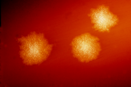 Kolonie Clostridium difficile. Na krevnĂ­m agaru vypadĂˇ hezky a neĹˇkodnÄ› (Kredit: Dr. Holdeman, Public Health Image Library)