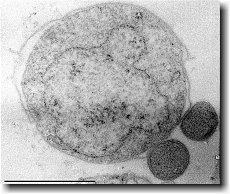 Nanoarchaeum equitans  se svĂ˝m hostitelem Ignicoccus  (Kredit: Karl O. Stetter)