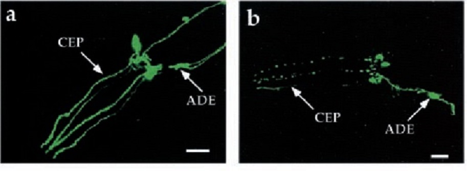 DopaminergnĂ­ neurony vystavenĂ© vlivu 6-hydroxydomapinu (vlevo) v porovnĂˇnĂ­ s kontrolou (vpravo) .  Zdroj: Nass, R., Hall, D. H., Miller, D. M., & Blakely, R. D. (2002). Neurotoxin-induced degeneration of dopamine neurons in Caenorhabditis elegans
