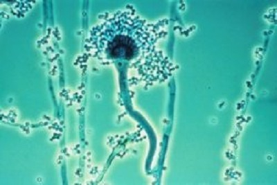 Aspergillus fumigatus. S touto houbou dělali výzkumníci své pokusy na myších. I jeho spóry jsou častým hostem lidských plicních sklípků.  Když se našemu imunitnímu systému nepodaří zavčasu zpacifikovat, vzniká vážný problém. Hyfy mají optimum růstu p