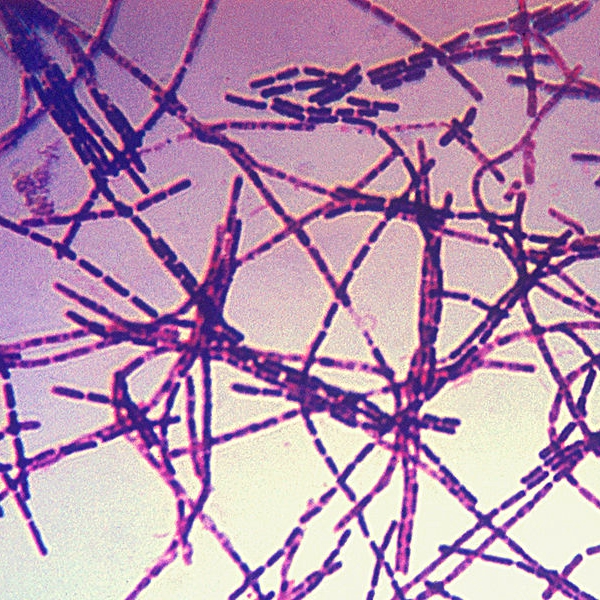ZlovÄ›stnĂ© tyÄŤinky bakteriĂ­ anthraxu. Kredit: CDC