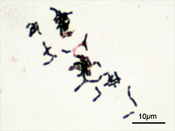 Bifidobacterium je celý rod anaerobních bakterií. Dříve se jim říkalo laktobacily. Některým, jako třeba B. Dentium, je lepší se vyvarovat, neboť se stará o to, aby zubní lékaři měli co dělat. Jiné z bifidobakterií se používají jako probiotika. Na sní