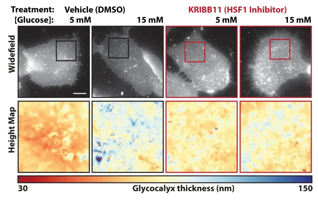 Výsledky blokování proteinu „heat shock factor 1“ (faktor tepelného šoku 1). Pomocí skenovací interferenční mikroskopie vědci prokázali, že inhibice tohoto proteinu zabránila ztluštění vnější ochranné vrstvy, kterou rakovinné buňky používají k oklamá
