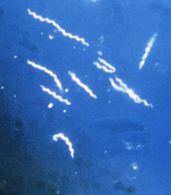Borélie. Kredit: CDC -  Public Health Image Library
