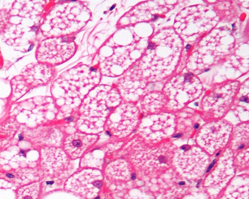 Podél velkých cév se v hojné míře nachází takzvaná hnědá tuková tkáň tvořená multivakuolárními adipocyty. Hnědé adipocyty obsahují četné mitochondrie, kde dochází k odpojení transportního řetězce elektronů a vytváření tepla. Vzhled tomuto typu tukové
