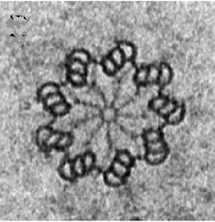 Centrioly jsou vĂˇlcovitĂ© struktury (0,15 Âµm v prĹŻmÄ›ru a 0,3 - 0,5 Âµm dlouhĂ©) sloĹľenĂ© pĹ™evĂˇĹľnÄ› z vysoce organizovanĂ˝ch mikrotubulĹŻ. Mutace v proteinech, kterĂ© je tvoĹ™Ă­, mohou zpĹŻsobit Ĺˇirokou ĹˇkĂˇlu onemocnÄ›nĂ­ -  od vĂ˝vojovĂ˝ch