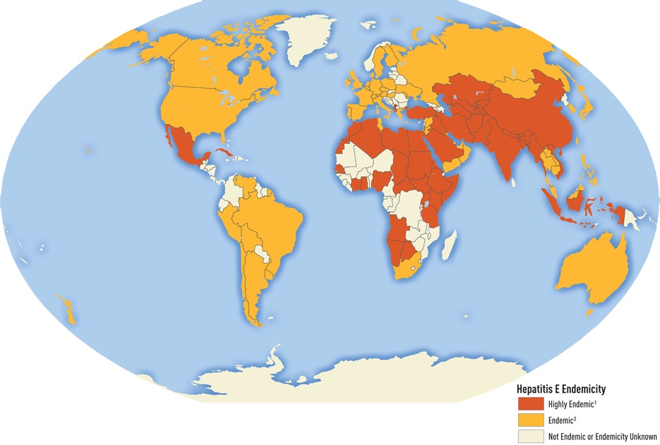 Epidemiologie hepatitidy C. Kredit: Mohd Hanafiah K, Groeger J, Flaxman AD, Wiersma ST. Global Epidemiology of Hepatitis C Virus Infection; New Estimates of Age-Specific Antibody to HCV and Seroprevalence. Hepatology. 2013