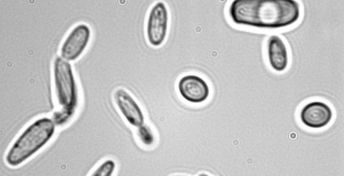 Kvasinka Dekkera bruxellensis. V pivovarnické, stejně jako vinařské branži, je její přítomnost krajně nežádoucí. Produktem jejího metabolismu je 4-etyl fenol a výsledkem  nemocniční aroma. (Kredit UC DAVIS)